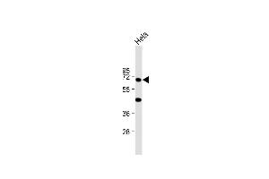 Anti-KRT10 Antibody (N-term) at 1:2000 dilution + Hela whole cell lysate Lysates/proteins at 20 μg per lane. (Keratin 10 Antikörper  (N-Term))