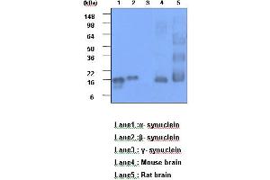 Western Blotting (WB) image for anti-Synuclein, alpha (SNCA) (AA 119-140) antibody (ABIN317562) (SNCA Antikörper  (AA 119-140))