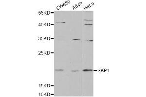 Western blot analysis of extracts of various cell lines, using SKP1 antibody. (SKP1 Antikörper)