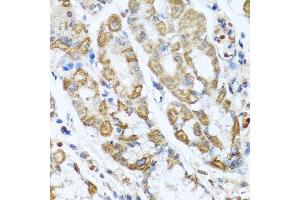 Immunohistochemistry of paraffin-embedded human gastric using ANTXR2 antibody at dilution of 1:100 (x40 lens). (ANTXR2 Antikörper)