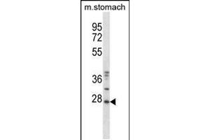 Western blot analysis in mouse stomach tissue lysates (35ug/lane). (TP53RK Antikörper  (AA 100-128))