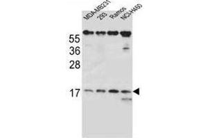 TCRB Antibody (Center) western blot analysis in MDA-MB231, 293, Ramos, NCI-H460 cell line lysates (35 µg/lane). (TCRb Antikörper  (Middle Region))