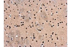 Immunohistochemistry (IHC) image for anti-Histone Deacetylase 1 (HDAC1) antibody (ABIN2854776)