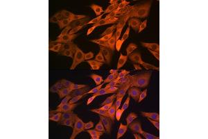 Immunofluorescence analysis of NIH-3T3 cells using SRP54 Rabbit mAb (ABIN3015958, ABIN3015959, ABIN1682276, ABIN1682277 and ABIN7101466) at dilution of 1:100 (40x lens). (SRP54 Antikörper)