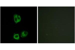 Immunofluorescence (IF) image for anti-Lymphocyte-Specific Protein tyrosine Kinase (LCK) (pTyr393) antibody (ABIN2888462) (LCK Antikörper  (pTyr393))