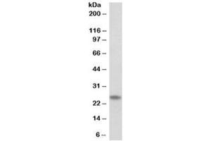 Western blot testing of human skeletal muscle lysate with TNNI1 antibody at 0. (TNNI1 Antikörper)