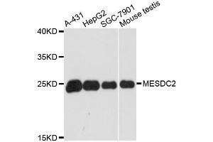Western blot analysis of extracts of various cell lines, using MESDC2 antibody. (MESDC2 Antikörper)