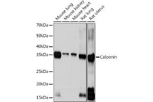 Western blot analysis of extracts of various cell lines, using Calponin Rabbit mAb (ABIN1678670, ABIN3018018, ABIN3018019 and ABIN7101568) at 1:1000 dilution. (CNN1 Antikörper)