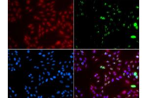 Immunofluorescence analysis of GFP-RNF168 transgenic U2OS cell using XPA antibody. (XPA Antikörper)