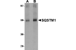Western blot analysis of SQSTM1 in Human spleen tissue lysate with SQSTM1 antibody at (A) 1 and (B) 2 µg/mL. (SQSTM1 Antikörper  (C-Term))