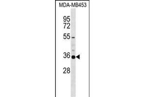 KCNA5 Antibody (C-term) (ABIN1537420 and ABIN2848693) western blot analysis in MDA-M cell line lysates (35 μg/lane). (KCNA5 Antikörper  (C-Term))