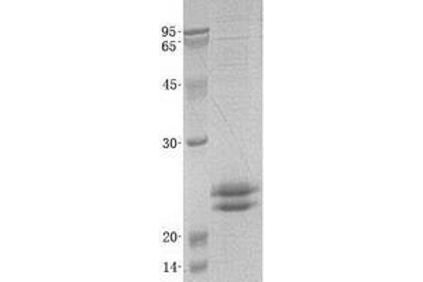 VMO1 Protein (Transcript Variant 3) (His tag)