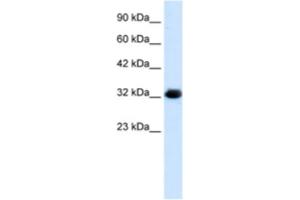 Western Blotting (WB) image for anti-Chromosome 22 Open Reading Frame 31 (C22orf31) antibody (ABIN2461056) (C22orf31 Antikörper)