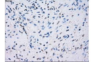 Immunohistochemical staining of paraffin-embedded prostate tissue using anti-FCGR2A mouse monoclonal antibody. (FCGR2A Antikörper)