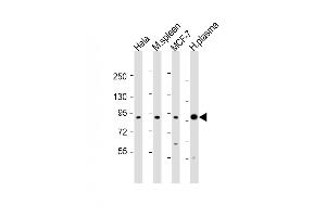 All lanes : Anti-GSN Antibody (C-term) at 1:1000-1:2000 dilution Lane 1: Hela whole cell lysates Lane 2: mouse spleen lysates Lane 3: MCF-7 whole cell lysates Lane 4: human plasma lysates Lysates/proteins at 20 μg per lane. (Gelsolin Antikörper  (C-Term))