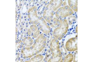 Immunohistochemistry of paraffin-embedded mouse kidney using HDAC6 antibody (ABIN5970867) at dilution of 1/100 (40x lens). (HDAC6 Antikörper)