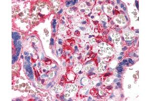 Anti-PF4 antibody IHC of human placenta. (PF4 Antikörper)