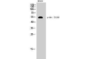 Western Blotting (WB) image for anti-V-Akt Murine Thymoma Viral Oncogene Homolog 1 (AKT1) (pSer124) antibody (ABIN6284601) (AKT1 Antikörper  (pSer124))