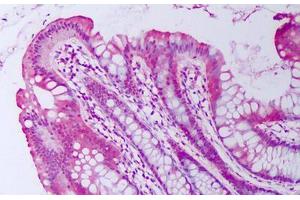 Anti-BMP2 antibody IHC staining of human colon, epithelium. (BMP2 Antikörper)