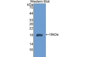 Detection of Recombinant HEXb, Mouse using Polyclonal Antibody to Hexosaminidase B Beta (HEXb) (HEXB Antikörper  (AA 294-435))