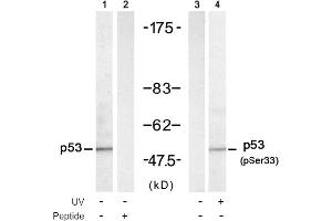 Image no. 1 for anti-Tumor Protein P53 (TP53) (pSer33) antibody (ABIN319215) (p53 Antikörper  (pSer33))