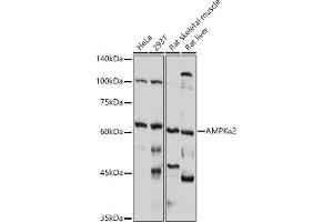 Western blot analysis of extracts of various cell lines, using AMPKα2 antibody (ABIN6129903, ABIN6146170, ABIN6146172 and ABIN6218273) at 1:1000 dilution. (PRKAA2 Antikörper  (AA 343-552))