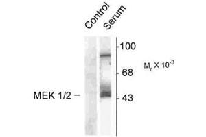 Image no. 1 for anti-Mitogen-Activated Protein Kinase Kinase 1 (MAP2K1) (pSer218), (Ser222) antibody (ABIN221121) (MEK1 Antikörper  (pSer218, Ser222))