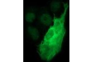 Image no. 2 for anti-Tyrosine Hydroxylase (TH) antibody (ABIN1501367) (Tyrosine Hydroxylase Antikörper)