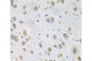 Immunohistochemistry of paraffin-embedded Mouse brain using GNE Polyclonal Antibody at dilution of 1:100 (40x lens). (GNE Antikörper)