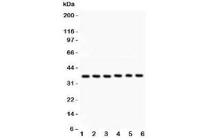 Western blot testing of Heme Oxygenase 2 antibody and Lane 1:  rat kidney;  2: human A549;  3: (h) COLO320;  4: (h) MM231;  5: (h) HeLa;  6: (h) SKOV. (HMOX2 Antikörper  (AA 2-316))