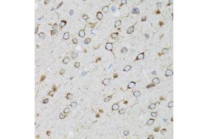 Immunohistochemistry of paraffin-embedded rat brain using UBE2D1 antibody (ABIN5971011) at dilution of 1/100 (40x lens). (UBE2D1 Antikörper)