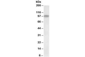 Western blot testing of human skeletal muscle lysate with DAG antibody at 0. (Dystroglycan Antikörper)