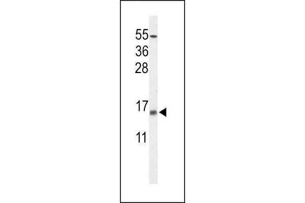 KCNE1-Like Antikörper  (AA 67-96)