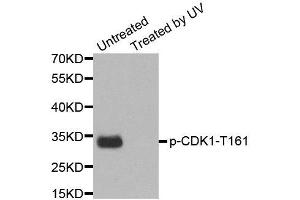 Western Blotting (WB) image for anti-Cyclin-Dependent Kinase 1 (CDK1) (pTyr15) antibody (ABIN1870049) (CDK1 Antikörper  (pTyr15))
