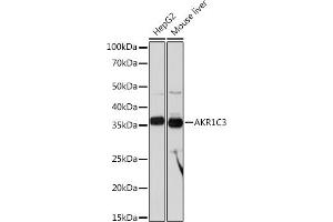 Western blot analysis of extracts of various cell lines, using C3 Rabbit mAb (ABIN1680027, ABIN3018233, ABIN3018234 and ABIN7101584) at 1:1000 dilution. (AKR1C3 Antikörper)