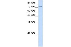 WB Suggested Anti-ZNF441 Antibody Titration:  1. (ZNF441 Antikörper  (N-Term))