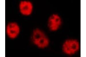 ABIN6267553 staining NIH-3T3 by IF/ICC. (LIMK-1/2 (pThr505), (pThr508) Antikörper)