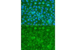 Immunofluorescence analysis of A549 cells using SERPINA3 antibody. (SERPINA3 Antikörper  (AA 24-423))