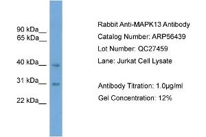 WB Suggested Anti-MAPK13  Antibody Titration: 0. (MAPK13 Antikörper  (Middle Region))
