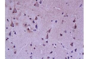 Formalin-fixed and paraffin embedded rat brain labeled with Rabbit Anti FABP7/BLBP/FABP(brain) Polyclonal Antibody, Unconjugated (ABIN739475) at 1:200 followed by conjugation to the secondary antibody and DAB staining (FABP7 Antikörper  (AA 6-23))