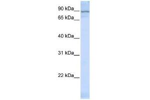 Western Blot showing ZNF598 antibody used at a concentration of 1-2 ug/ml to detect its target protein. (ZNF598 Antikörper  (Middle Region))