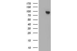Western Blotting (WB) image for anti-Catenin (Cadherin-Associated Protein), beta 1, 88kDa (CTNNB1) antibody (ABIN1496895) (CTNNB1 Antikörper)