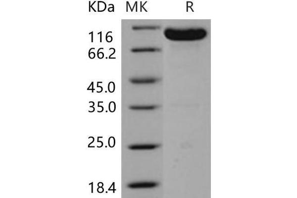 EPH Receptor B4 Protein (EPHB4) (Fc Tag)