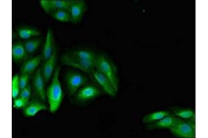 Immunofluorescent analysis of HepG2 cells using ABIN7150681 at dilution of 1:100 and Alexa Fluor 488-congugated AffiniPure Goat Anti-Rabbit IgG(H+L) (PDE11A Antikörper  (AA 42-190))