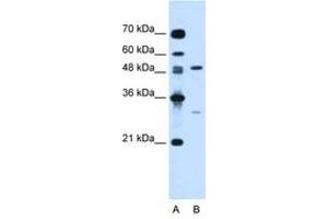 Image no. 1 for anti-Colony Stimulating Factor 1 (Macrophage) (CSF1) (N-Term) antibody (ABIN6736671) (M-CSF/CSF1 Antikörper  (N-Term))