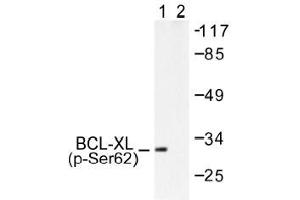 Image no. 1 for anti-BCL2-Like 1 (BCL2L1) (pSer62) antibody (ABIN317973) (BCL2L1 Antikörper  (pSer62))
