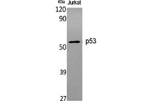 Western Blot analysis of various cells using p53 Polyclonal Antibody diluted at 1:1000. (p53 Antikörper)