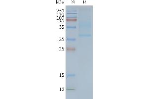 Human CD47-Nanodisc, Flag Tag on SDS-PAGE (CD47 Protein (CD47))