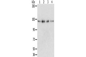 Western Blotting (WB) image for anti-RNA Binding Motif Protein 5 (RBM5) antibody (ABIN2424058) (RBM5 Antikörper)