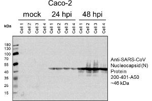 Western Blotting (WB) image for anti-SARS-Coronavirus Nucleocapsid Protein (SARS-CoV N) antibody (ABIN6952544)